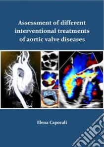 Assessment of different interventional treatments of aortic valve diseases. Ediz. speciale libro di Caporali Elena