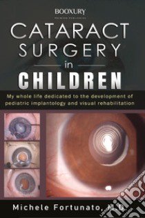 Cataract surgery in children libro di Fortunato Michele