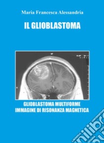 Il glioblastoma libro di Alessandria Maria Francesca