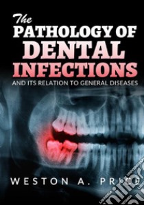 The pathology of dental infections and its relation to general diseases libro di Price Weston A.