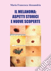 Il melanoma: aspetti storici e nuove scoperte libro di Alessandria Maria Francesca